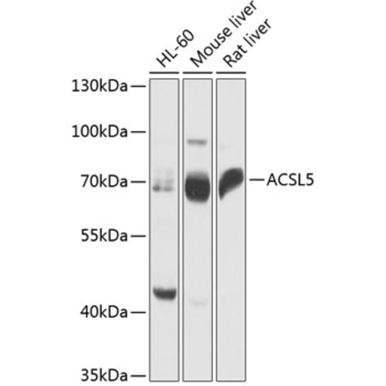 Western Blot - Anti-ACSL5 Antibody (A91172) - Antibodies.com