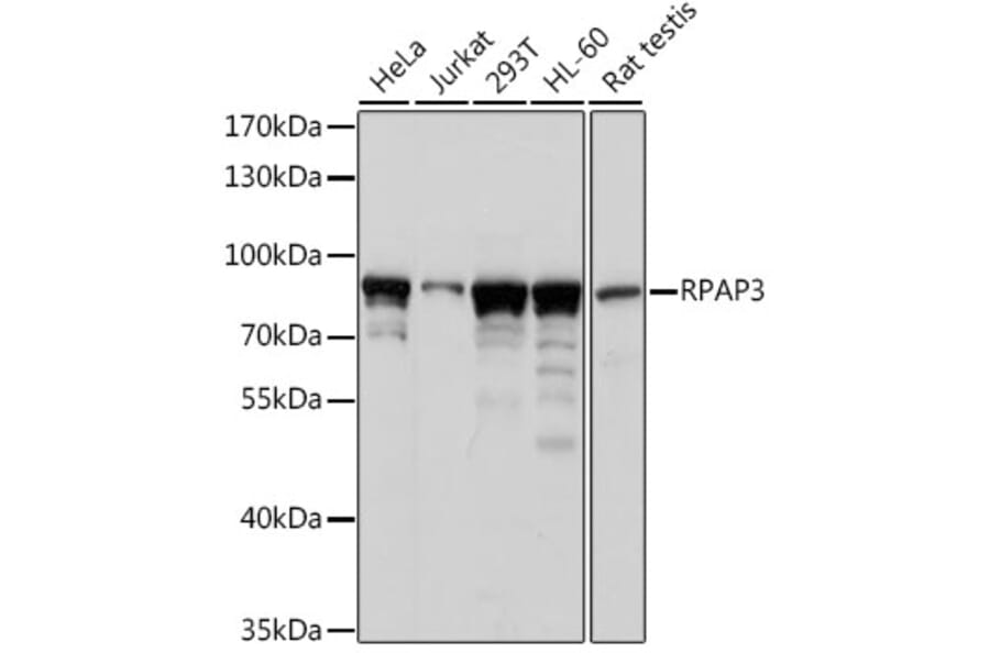 Western Blot - Anti-Hypothetical Protein FLJ21908/RPAP3 Antibody (A91173) - Antibodies.com