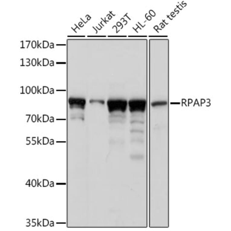 Western Blot - Anti-Hypothetical Protein FLJ21908/RPAP3 Antibody (A91173) - Antibodies.com