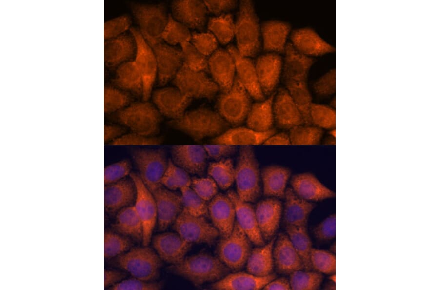 Immunofluorescence - Anti-Hypothetical Protein FLJ21908/RPAP3 Antibody (A91173) - Antibodies.com