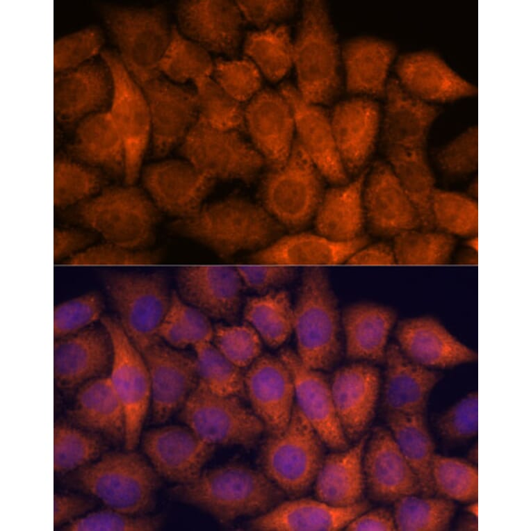 Immunofluorescence - Anti-Hypothetical Protein FLJ21908/RPAP3 Antibody (A91173) - Antibodies.com