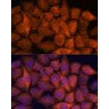 Immunofluorescence - Anti-Hypothetical Protein FLJ21908/RPAP3 Antibody (A91173) - Antibodies.com