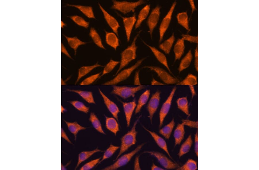 Immunofluorescence - Anti-Hypothetical Protein FLJ21908/RPAP3 Antibody (A91173) - Antibodies.com