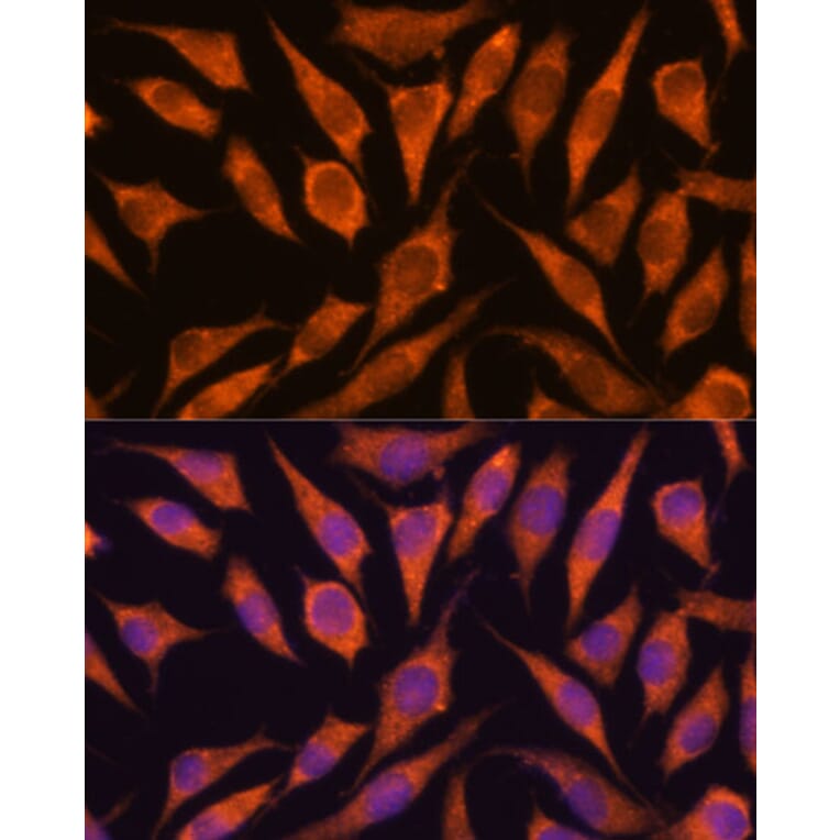 Immunofluorescence - Anti-Hypothetical Protein FLJ21908/RPAP3 Antibody (A91173) - Antibodies.com