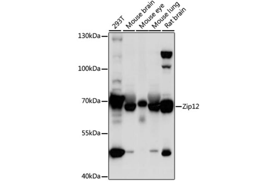 Western Blot - Anti-ZIP-12 Antibody (A91174) - Antibodies.com