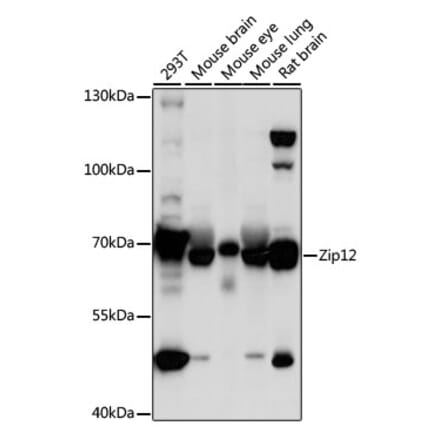 Western Blot - Anti-ZIP-12 Antibody (A91174) - Antibodies.com