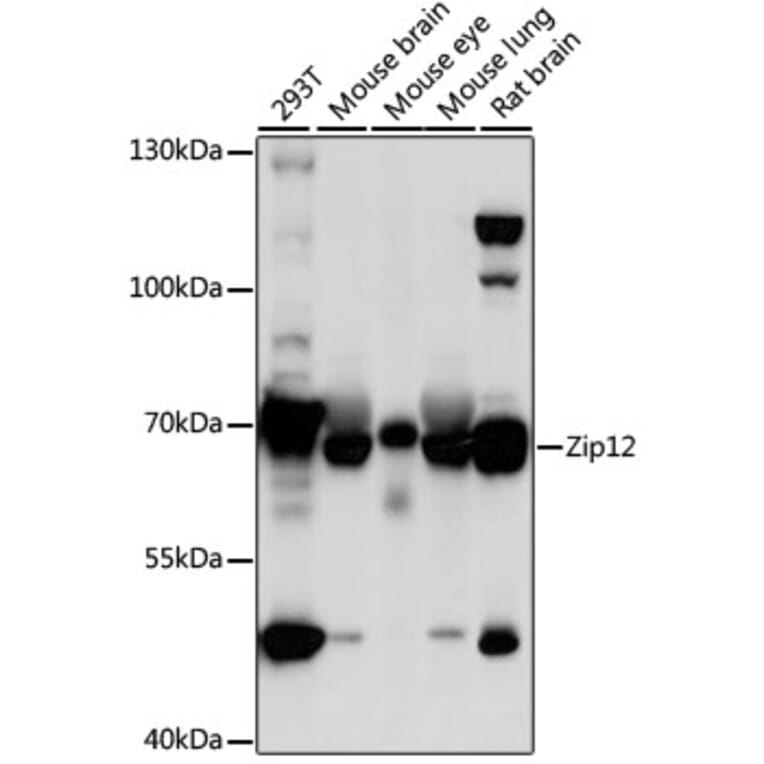 Western Blot - Anti-ZIP-12 Antibody (A91174) - Antibodies.com