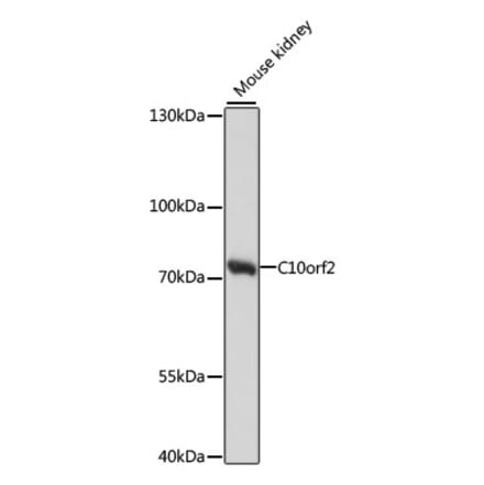 Western Blot - Anti-Twinkle Antibody (A91175) - Antibodies.com