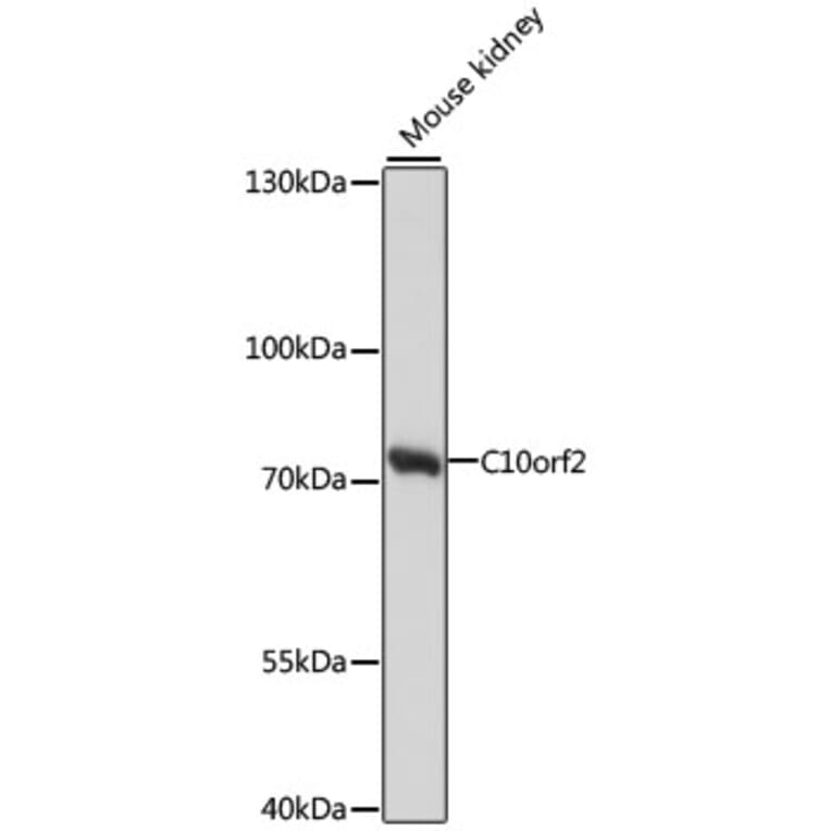 Western Blot - Anti-Twinkle Antibody (A91175) - Antibodies.com