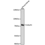 Western Blot - Anti-Twinkle Antibody (A91175) - Antibodies.com