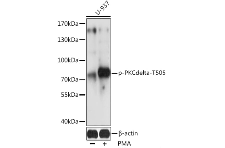 Western Blot - Anti-PKC delta (phospho Thr505) Antibody (A91176) - Antibodies.com