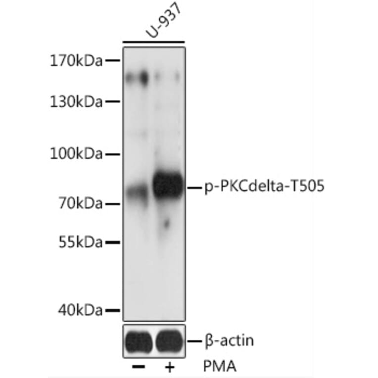 Western Blot - Anti-PKC delta (phospho Thr505) Antibody (A91176) - Antibodies.com