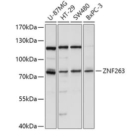 Western Blot - Anti-ZNF263 Antibody (A91177) - Antibodies.com