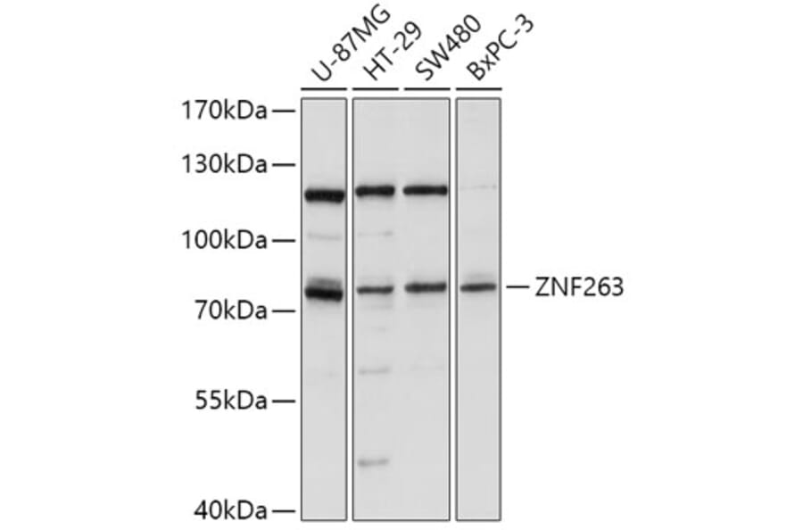 Western Blot - Anti-ZNF263 Antibody (A91177) - Antibodies.com