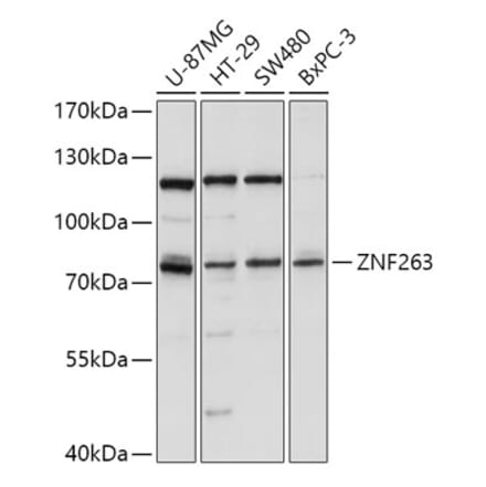 Western Blot - Anti-ZNF263 Antibody (A91177) - Antibodies.com