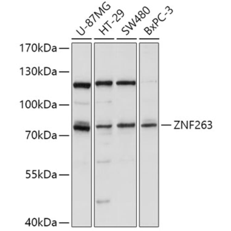 Western Blot - Anti-ZNF263 Antibody (A91177) - Antibodies.com
