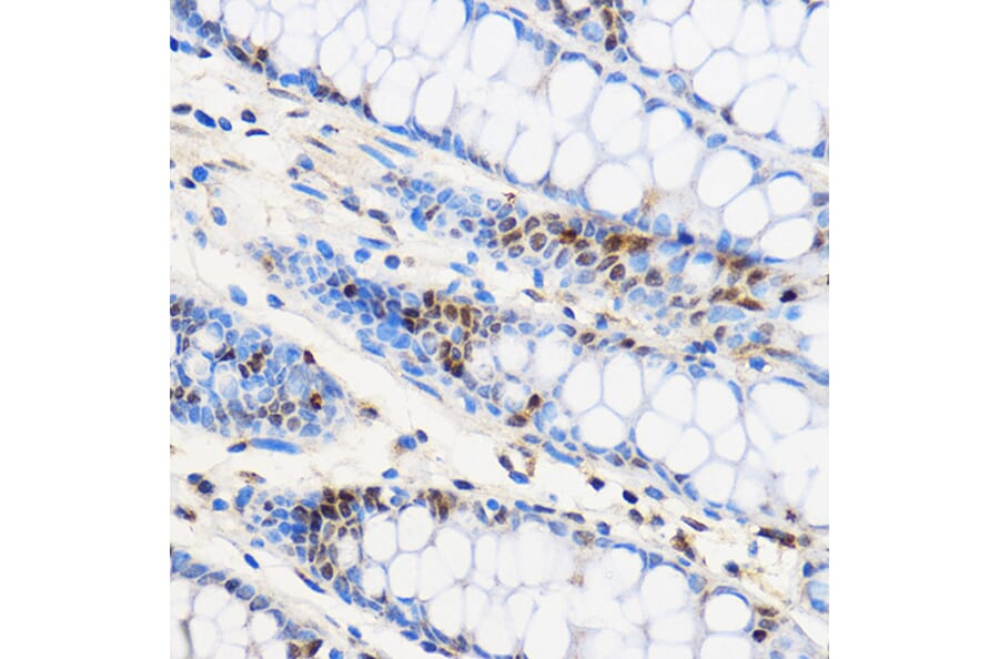 Immunohistochemistry - Anti-ZNF263 Antibody (A91177) - Antibodies.com