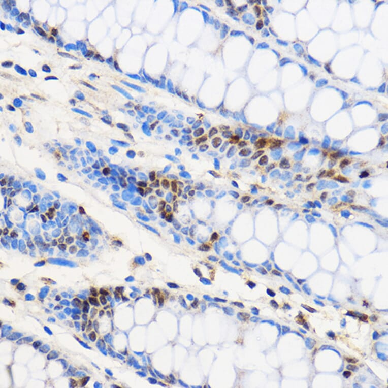 Immunohistochemistry - Anti-ZNF263 Antibody (A91177) - Antibodies.com