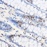 Immunohistochemistry - Anti-ZNF263 Antibody (A91177) - Antibodies.com