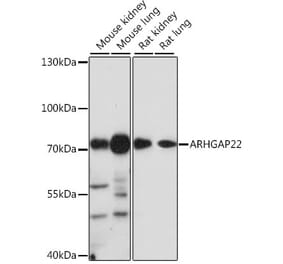 Western Blot - Anti-ARHGAP22 Antibody (A91178) - Antibodies.com