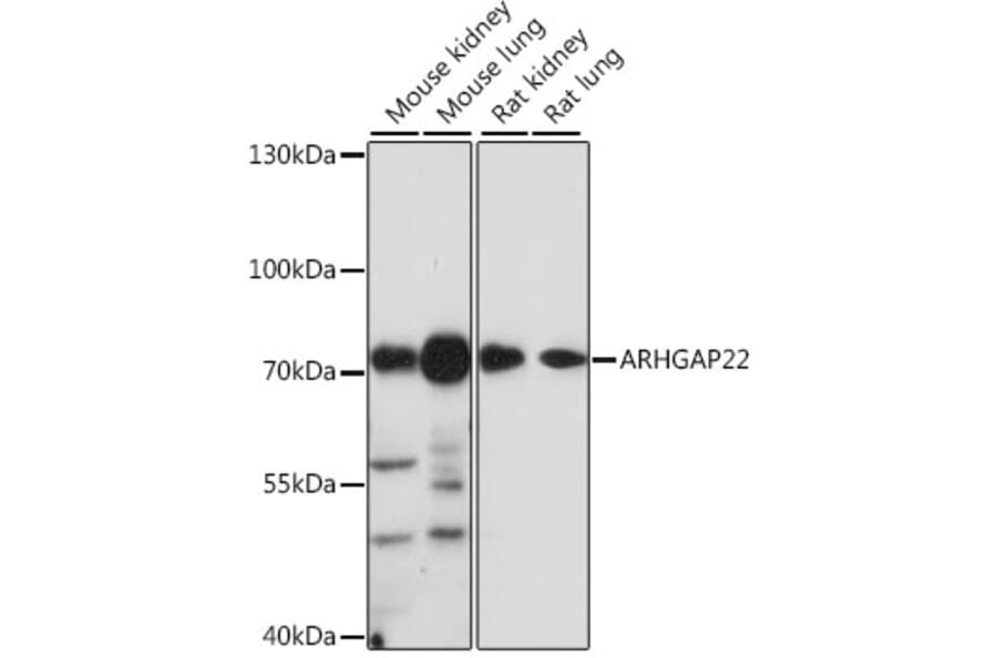Western Blot - Anti-ARHGAP22 Antibody (A91178) - Antibodies.com