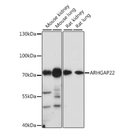 Western Blot - Anti-ARHGAP22 Antibody (A91178) - Antibodies.com