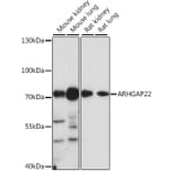 Western Blot - Anti-ARHGAP22 Antibody (A91178) - Antibodies.com