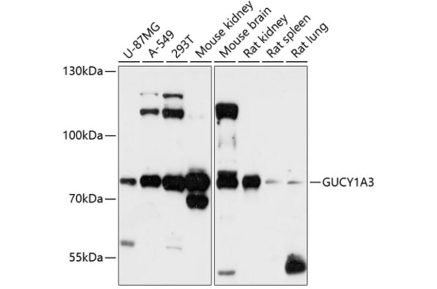 Western Blot - Anti-Guanylyl Cyclase alpha 1/GUCY1A3 Antibody (A91179) - Antibodies.com