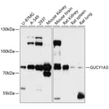 Western Blot - Anti-Guanylyl Cyclase alpha 1/GUCY1A3 Antibody (A91179) - Antibodies.com