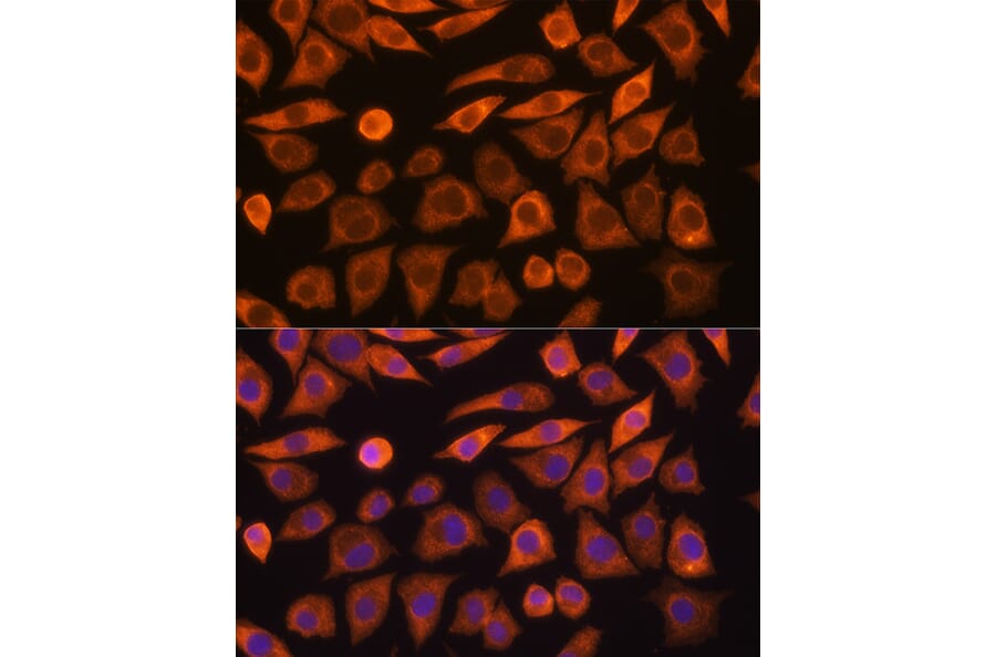 Immunofluorescence - Anti-Guanylyl Cyclase alpha 1/GUCY1A3 Antibody (A91179) - Antibodies.com
