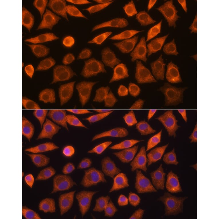 Immunofluorescence - Anti-Guanylyl Cyclase alpha 1/GUCY1A3 Antibody (A91179) - Antibodies.com