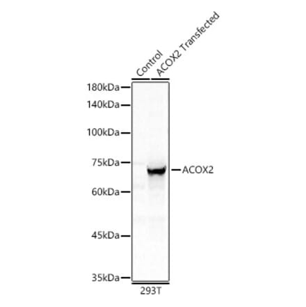 Western Blot - Anti-ACOX2 Antibody (A91180) - Antibodies.com