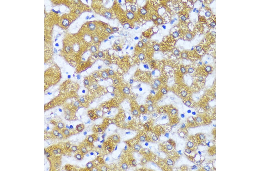 Immunohistochemistry - Anti-ACOX2 Antibody (A91180) - Antibodies.com
