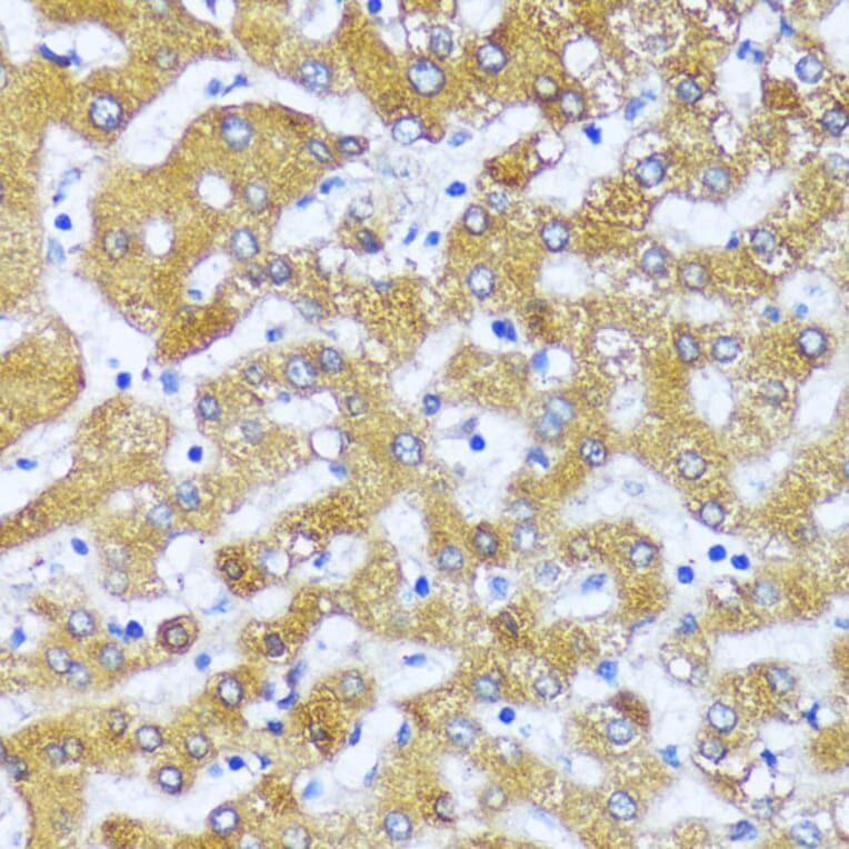 Immunohistochemistry - Anti-ACOX2 Antibody (A91180) - Antibodies.com