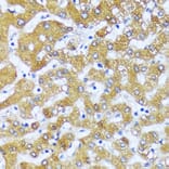 Immunohistochemistry - Anti-ACOX2 Antibody (A91180) - Antibodies.com