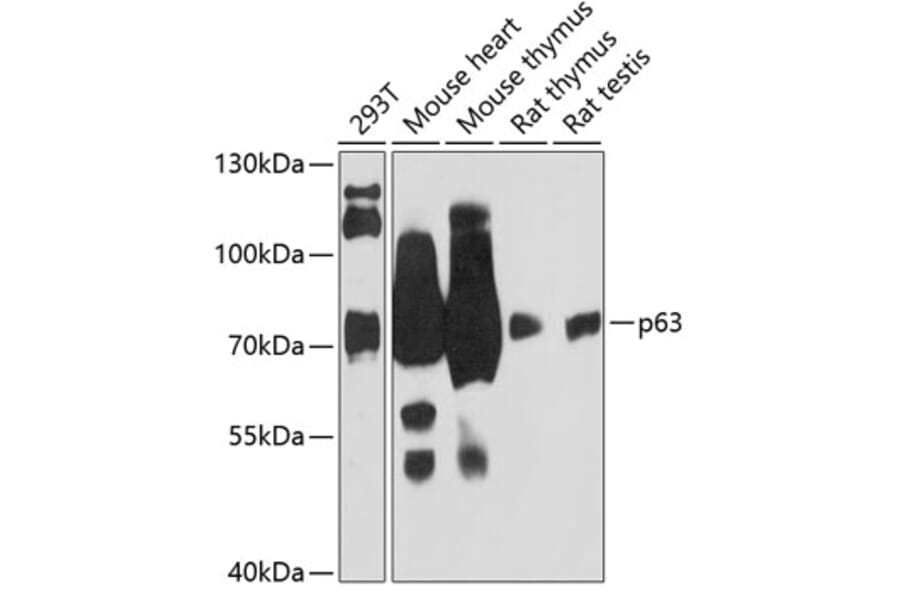 Western Blot - Anti-p63 Antibody (A91181) - Antibodies.com