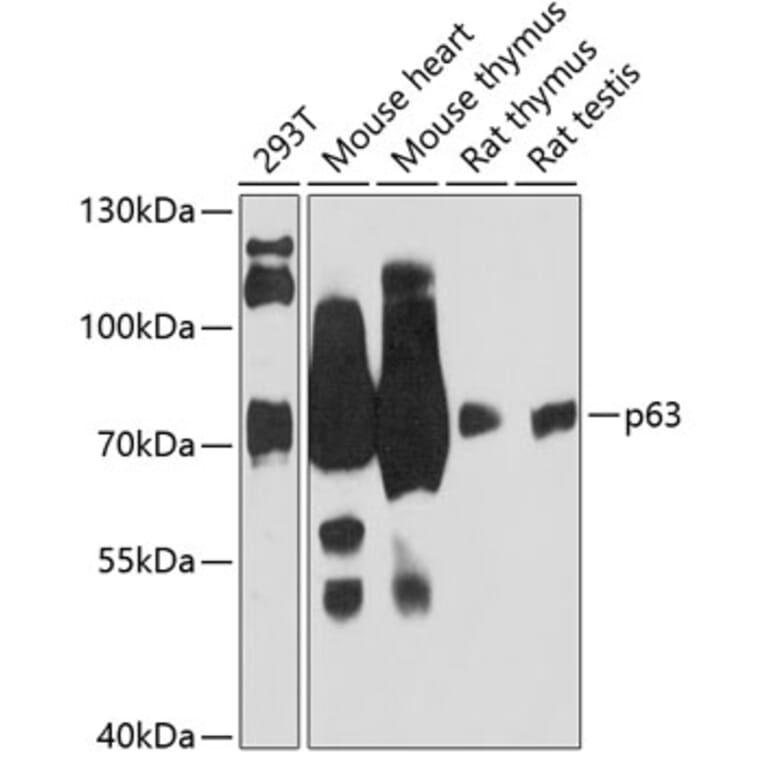 Western Blot - Anti-p63 Antibody (A91181) - Antibodies.com