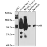 Western Blot - Anti-p63 Antibody (A91181) - Antibodies.com