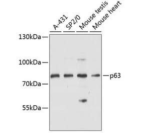 Western Blot - Anti-p63 Antibody (A91182) - Antibodies.com