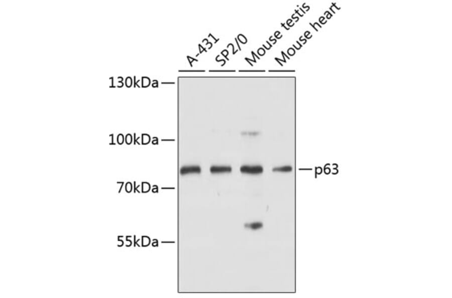 Western Blot - Anti-p63 Antibody (A91182) - Antibodies.com