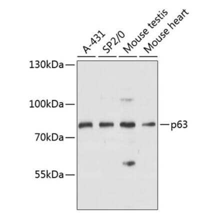 Western Blot - Anti-p63 Antibody (A91182) - Antibodies.com