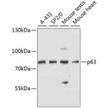 Western Blot - Anti-p63 Antibody (A91182) - Antibodies.com