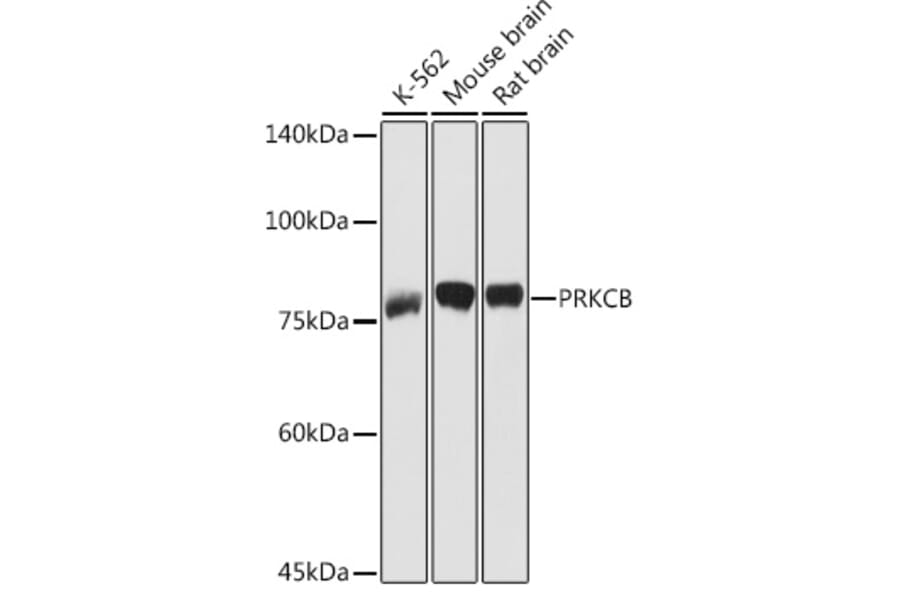 Western Blot - Anti-PKC beta Antibody (A91183) - Antibodies.com