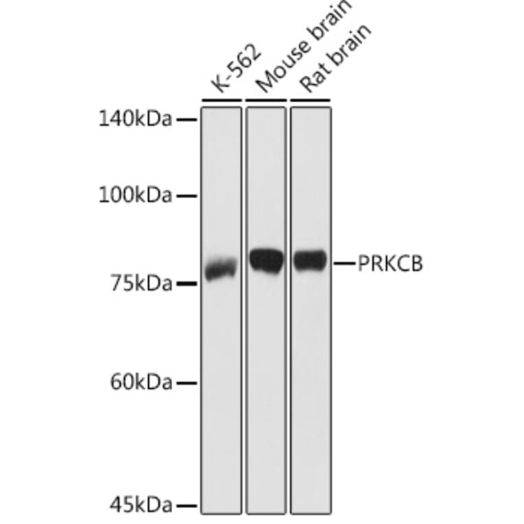 Western Blot - Anti-PKC beta Antibody (A91183) - Antibodies.com