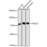 Western Blot - Anti-PKC beta Antibody (A91183) - Antibodies.com