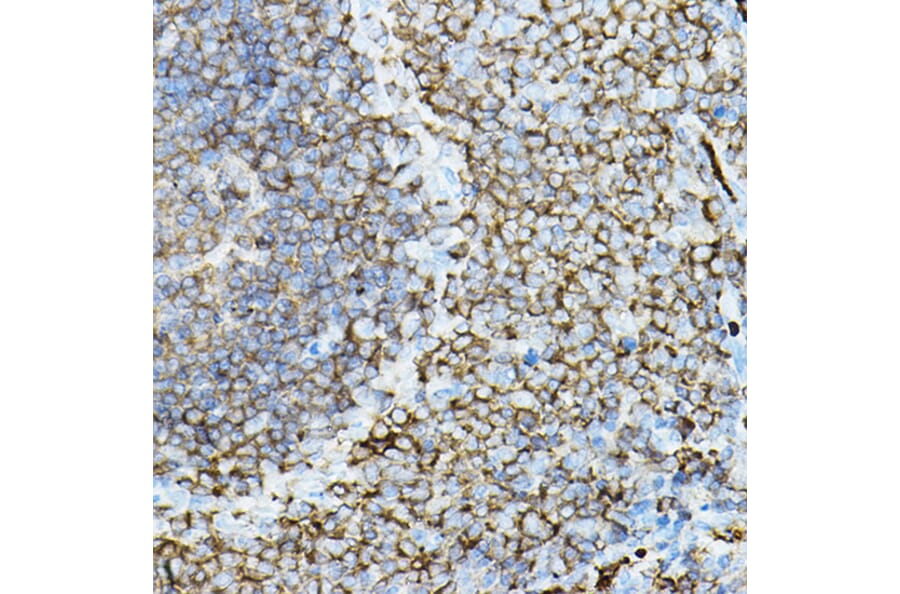 Immunohistochemistry - Anti-PKC beta Antibody (A91183) - Antibodies.com