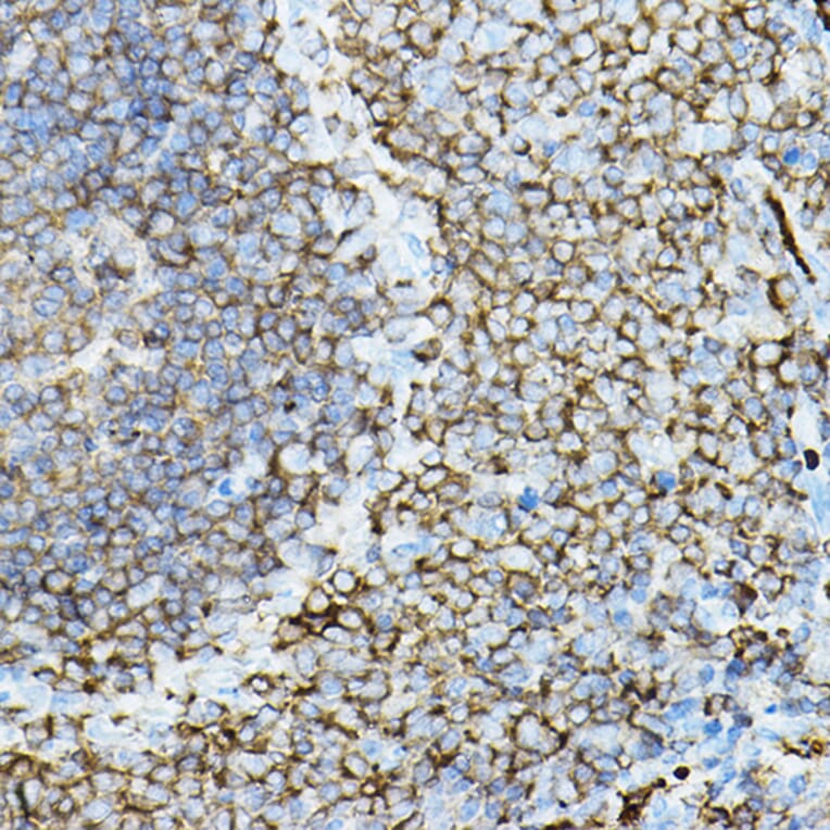 Immunohistochemistry - Anti-PKC beta Antibody (A91183) - Antibodies.com