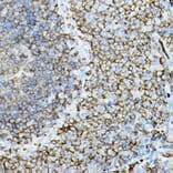 Immunohistochemistry - Anti-PKC beta Antibody (A91183) - Antibodies.com