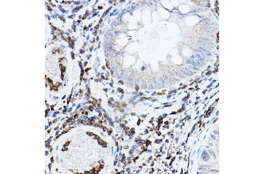 Immunohistochemistry - Anti-PKC beta Antibody (A91183) - Antibodies.com