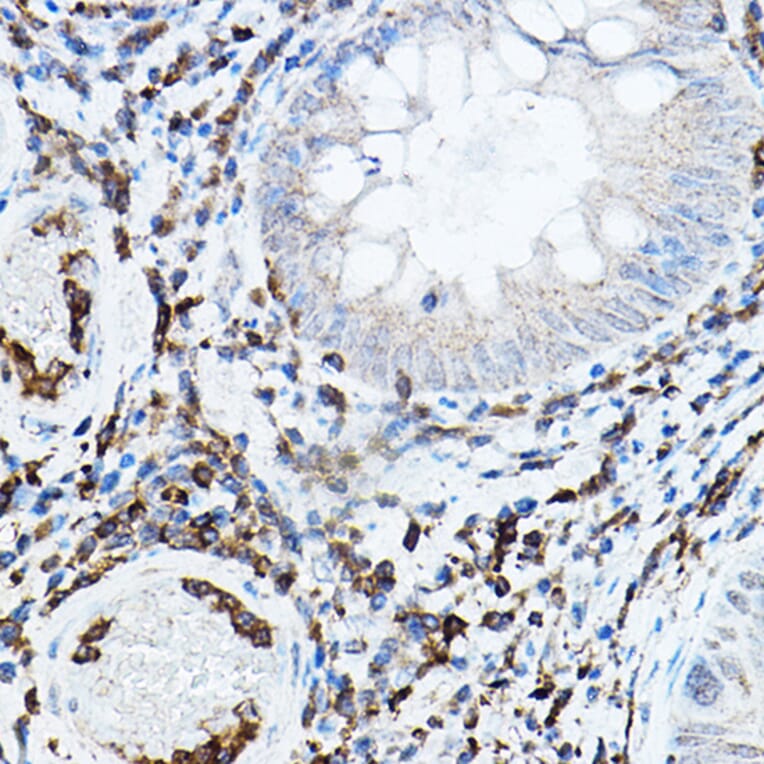 Immunohistochemistry - Anti-PKC beta Antibody (A91183) - Antibodies.com